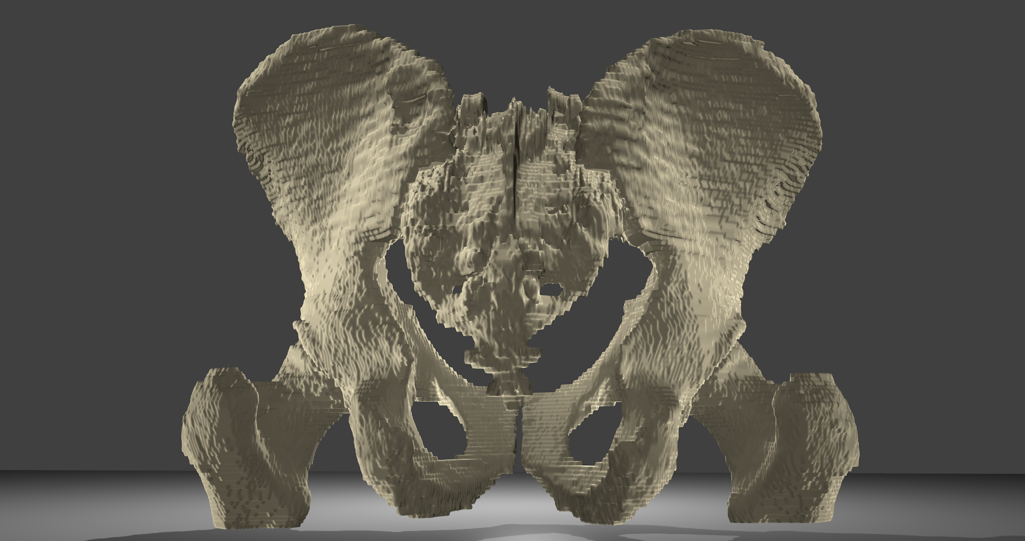 3D-Modell Beckenknochen:Beckenknochen mit Oberschenkelknochen und Kreuzbein, männlich. Voxelmodell, Ansicht von hinten.