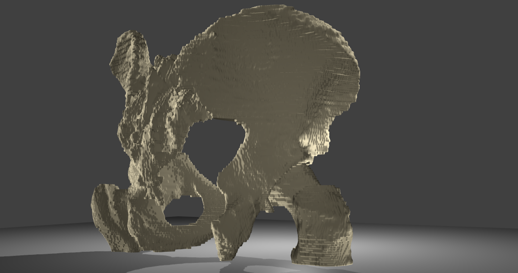 3D-Modell BeckenknochenBeckenknochen mit Oberschenkelknochen und Kreuzbein, männlich. Übersichtsbild, Voxelmodell, Ansicht von rechts hinten.