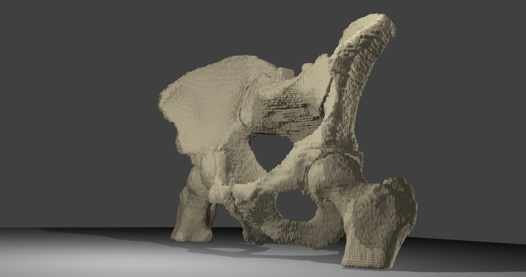 3D-Modell BeckenknochenBeckenknochen mit Oberschenkelknochen und Kreuzbein, männlich. Übersichtsbild, Voxelmodell, Ansicht von vorne links.